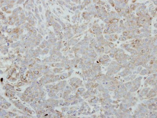 FBLIM1 Antibody in Immunohistochemistry (Paraffin) (IHC (P))