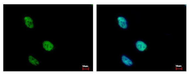 KLHDC4 Antibody in Immunocytochemistry (ICC/IF)