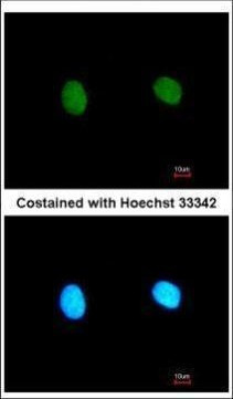 MED18 Antibody in Immunocytochemistry (ICC/IF)