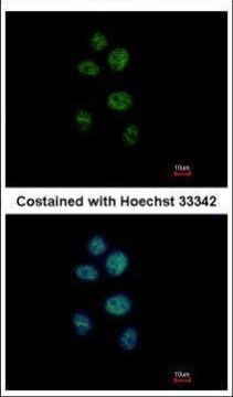 ZNF83 Antibody in Immunocytochemistry (ICC/IF)