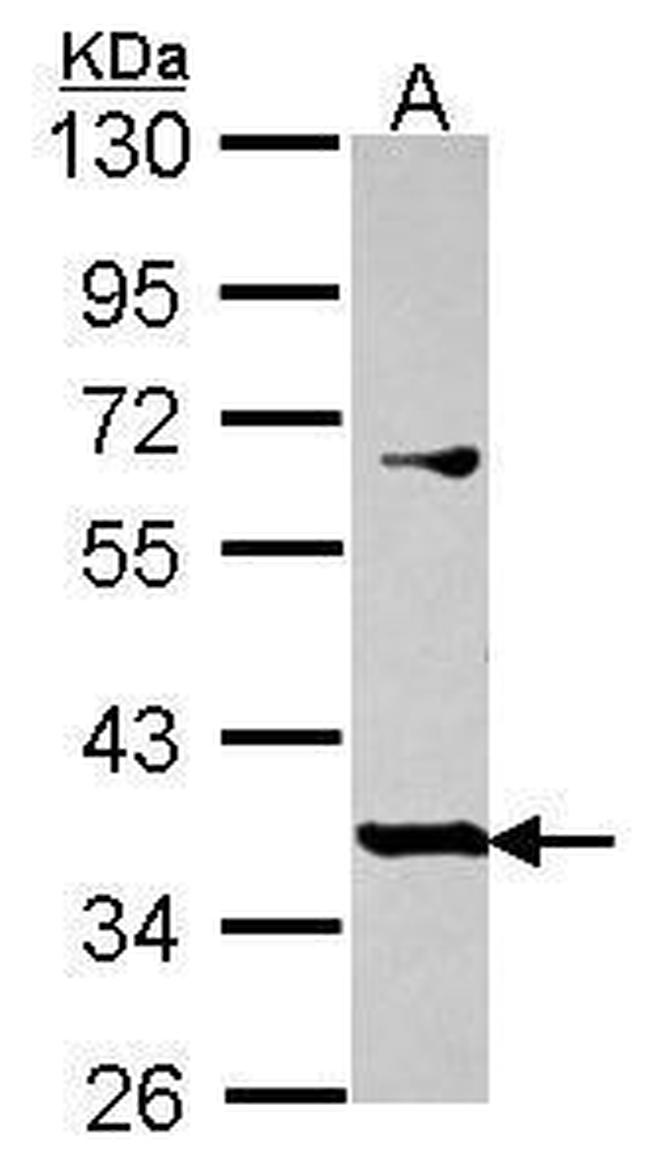 PRR11 Antibody in Western Blot (WB)
