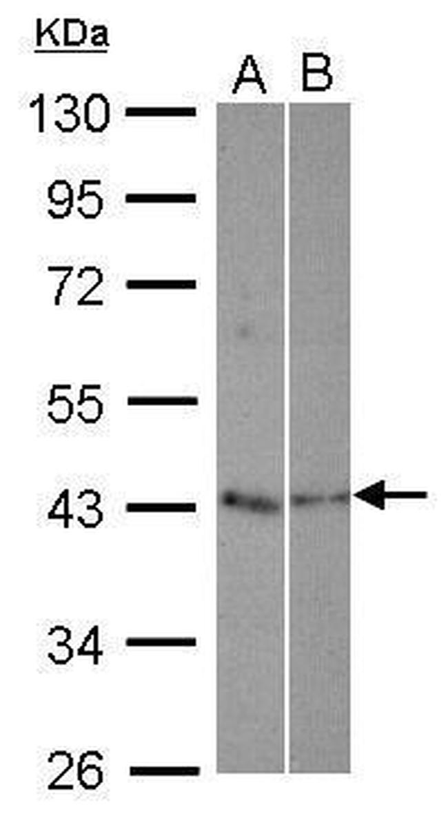 TEX13A Antibody in Western Blot (WB)