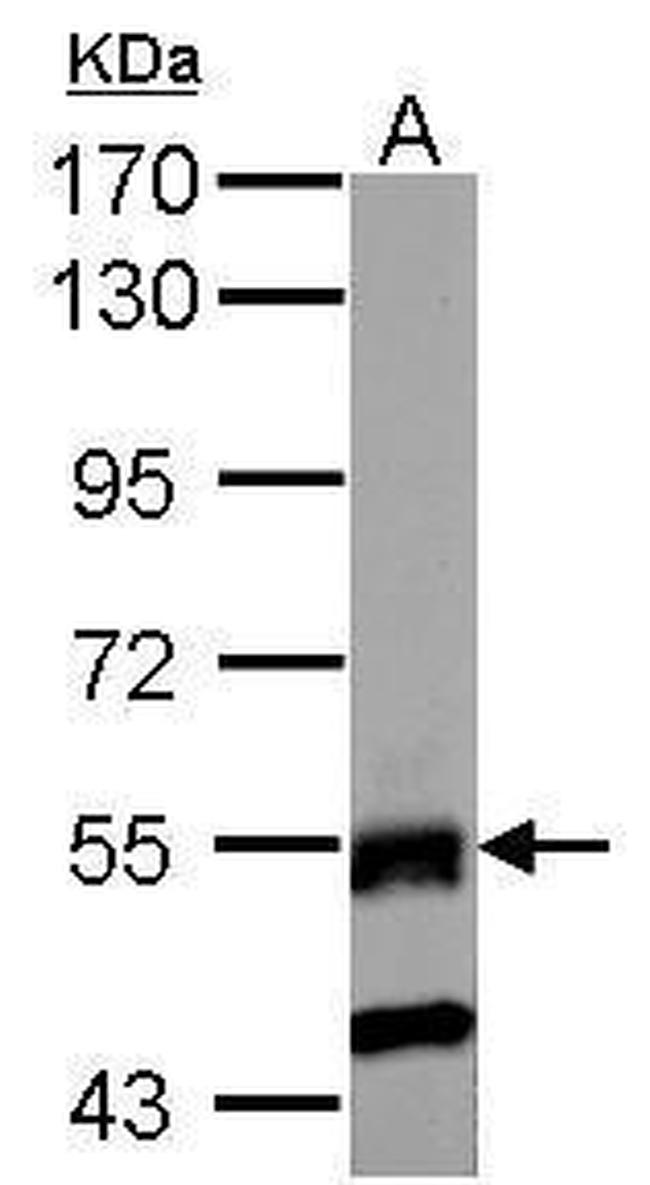 RNF23 Antibody in Western Blot (WB)
