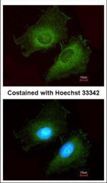 AKR1B10 Antibody in Immunocytochemistry (ICC/IF)