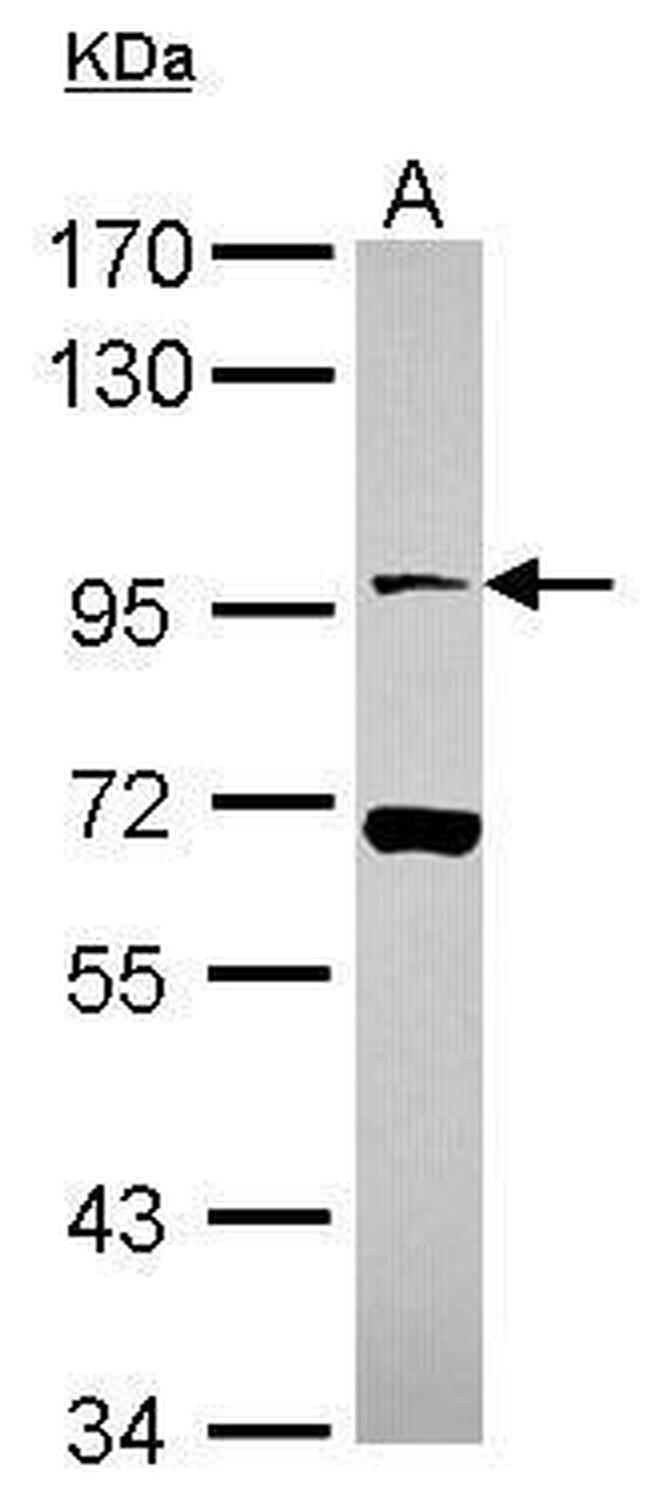 NLGN4X Antibody in Western Blot (WB)