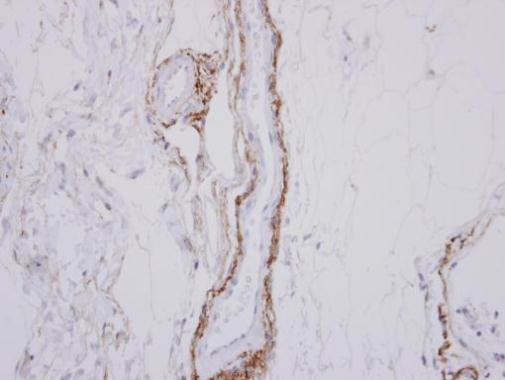 SH3RF1 Antibody in Immunohistochemistry (Paraffin) (IHC (P))