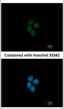 p400 Antibody in Immunocytochemistry (ICC/IF)