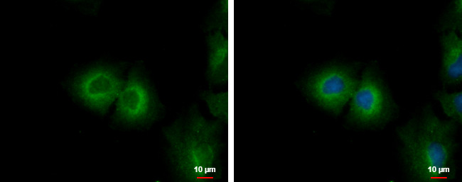 CYP4F11 Antibody in Immunocytochemistry (ICC/IF)