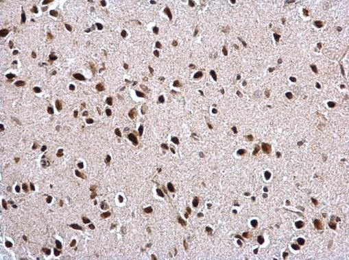 PTBP2 Antibody in Immunohistochemistry (Paraffin) (IHC (P))