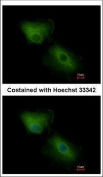 CXCL16 Antibody in Immunocytochemistry (ICC/IF)