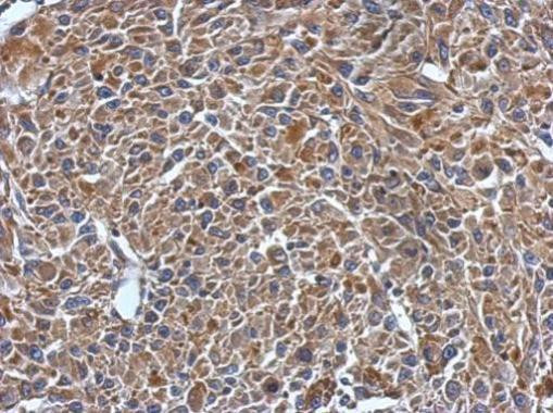 MYL7 Antibody in Immunohistochemistry (Paraffin) (IHC (P))