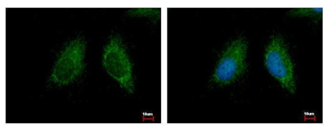 MCCC2 Antibody in Immunocytochemistry (ICC/IF)