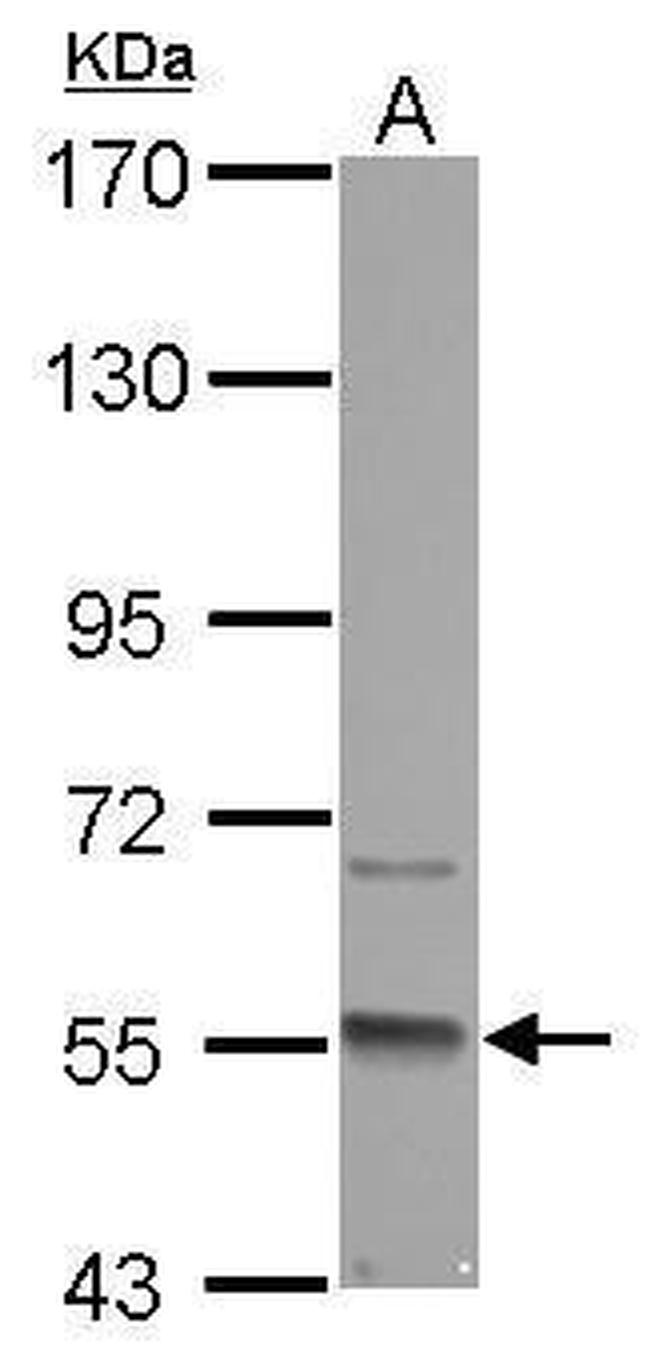 GMCL1 Antibody in Western Blot (WB)