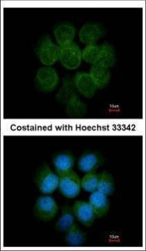 MTMR14 Antibody in Immunocytochemistry (ICC/IF)
