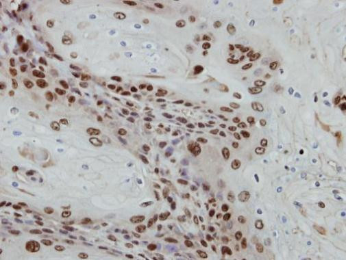 POLR1E Antibody in Immunohistochemistry (Paraffin) (IHC (P))