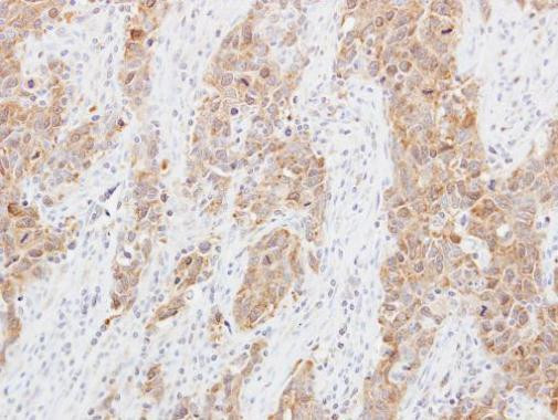 MRPL1 Antibody in Immunohistochemistry (Paraffin) (IHC (P))