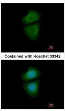 WDR77 Antibody in Immunocytochemistry (ICC/IF)