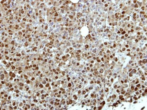 ZNF426 Antibody in Immunohistochemistry (Paraffin) (IHC (P))