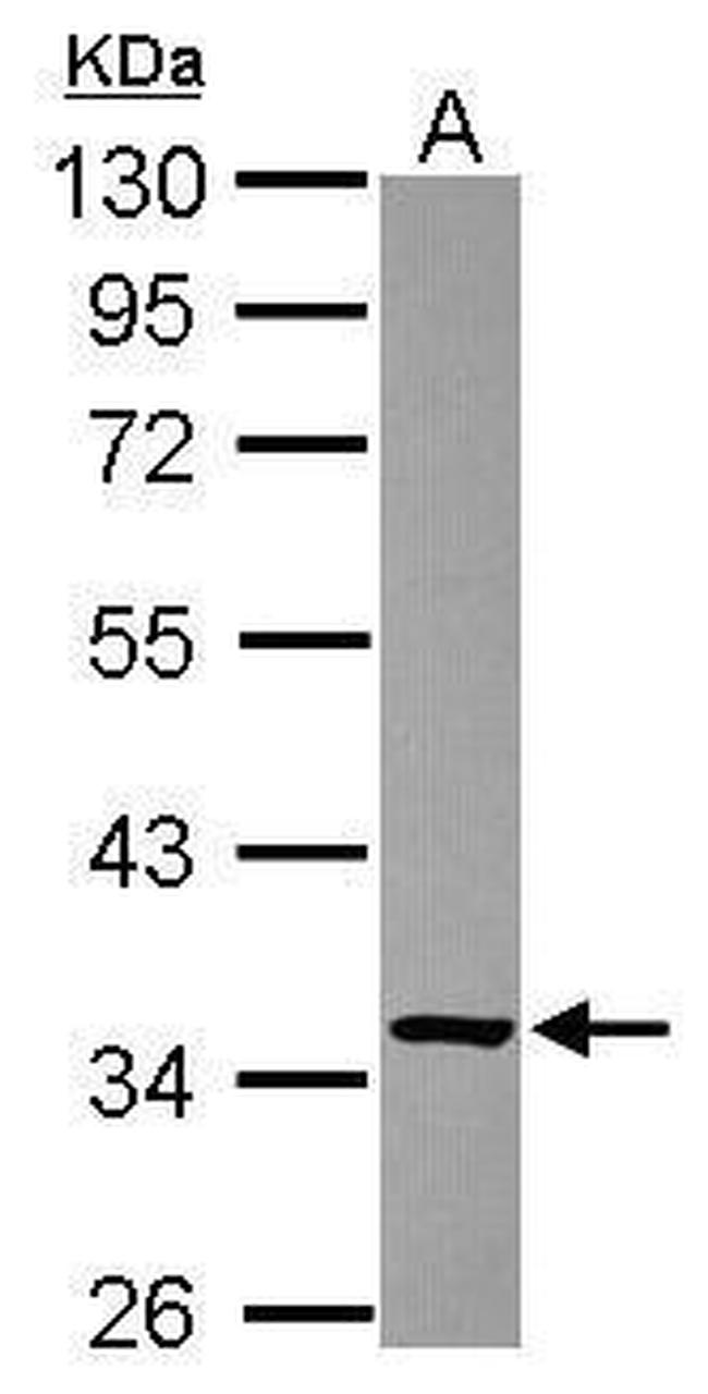 FN3KRP Antibody in Western Blot (WB)