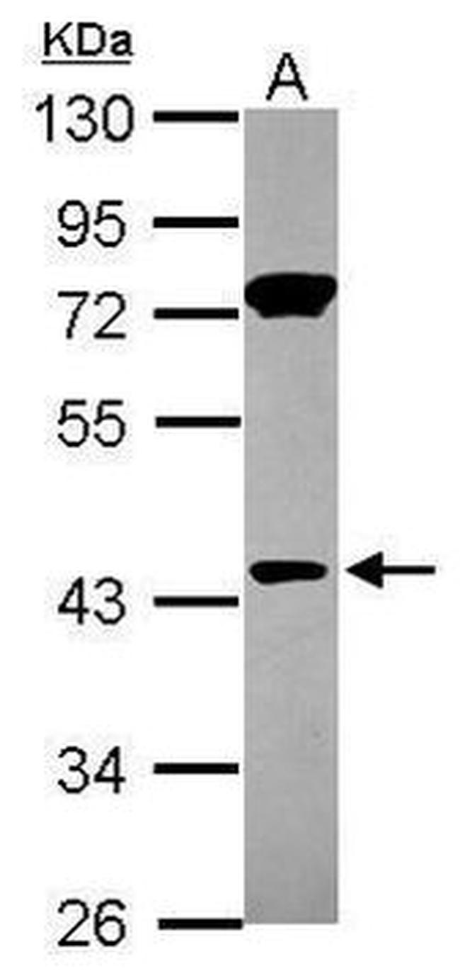 GSDMD Antibody in Western Blot (WB)