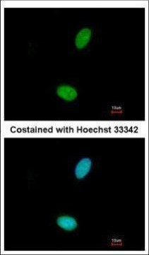 ZNF408 Antibody in Immunocytochemistry (ICC/IF)