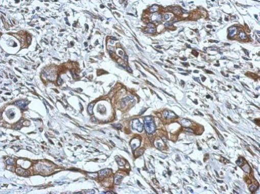 HPS6 Antibody in Immunohistochemistry (Paraffin) (IHC (P))