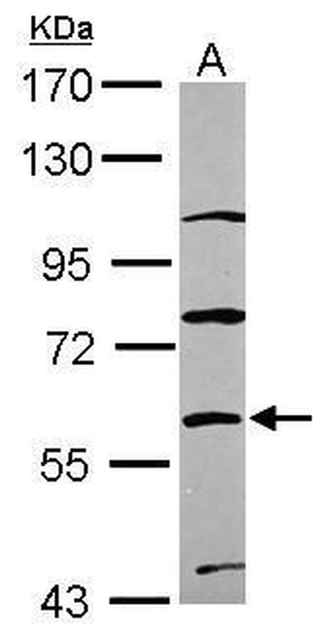ZNF671 Antibody in Western Blot (WB)