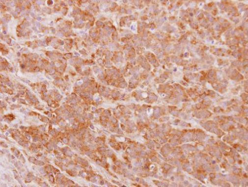 PHF17 Antibody in Immunohistochemistry (Paraffin) (IHC (P))
