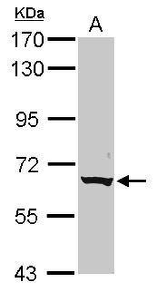 CLPTM1L Antibody in Western Blot (WB)