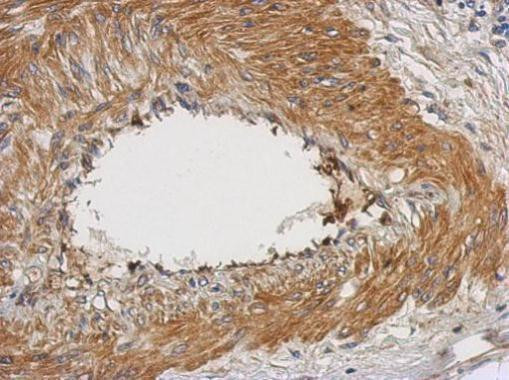 NUAK2 Antibody in Immunohistochemistry (Paraffin) (IHC (P))
