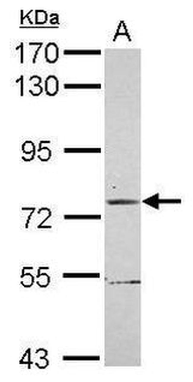 TRIM56 Antibody in Western Blot (WB)