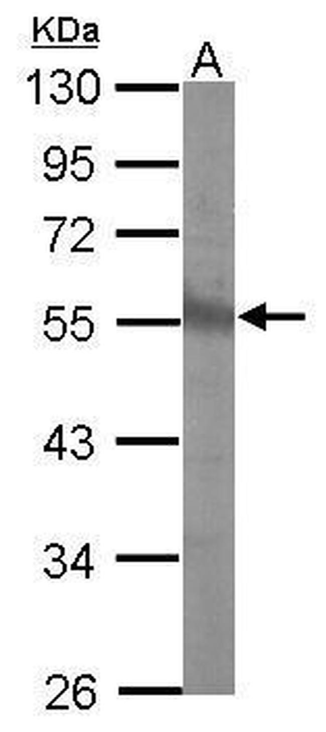 CHST9 Antibody in Western Blot (WB)