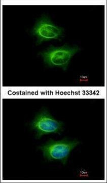 ASCC2 Antibody in Immunocytochemistry (ICC/IF)
