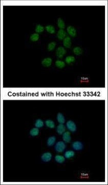 C1orf57 Antibody in Immunocytochemistry (ICC/IF)