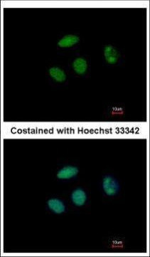 PHF6 Antibody in Immunocytochemistry (ICC/IF)