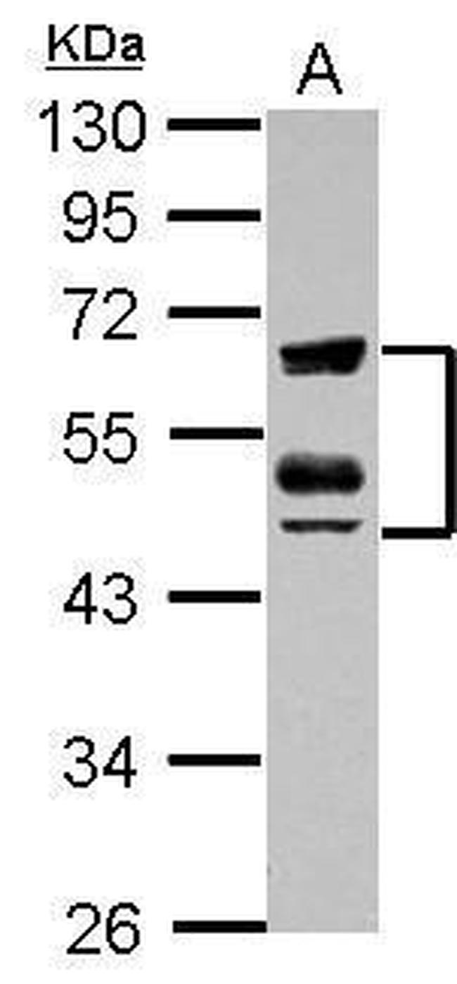 ZFYVE19 Antibody in Western Blot (WB)