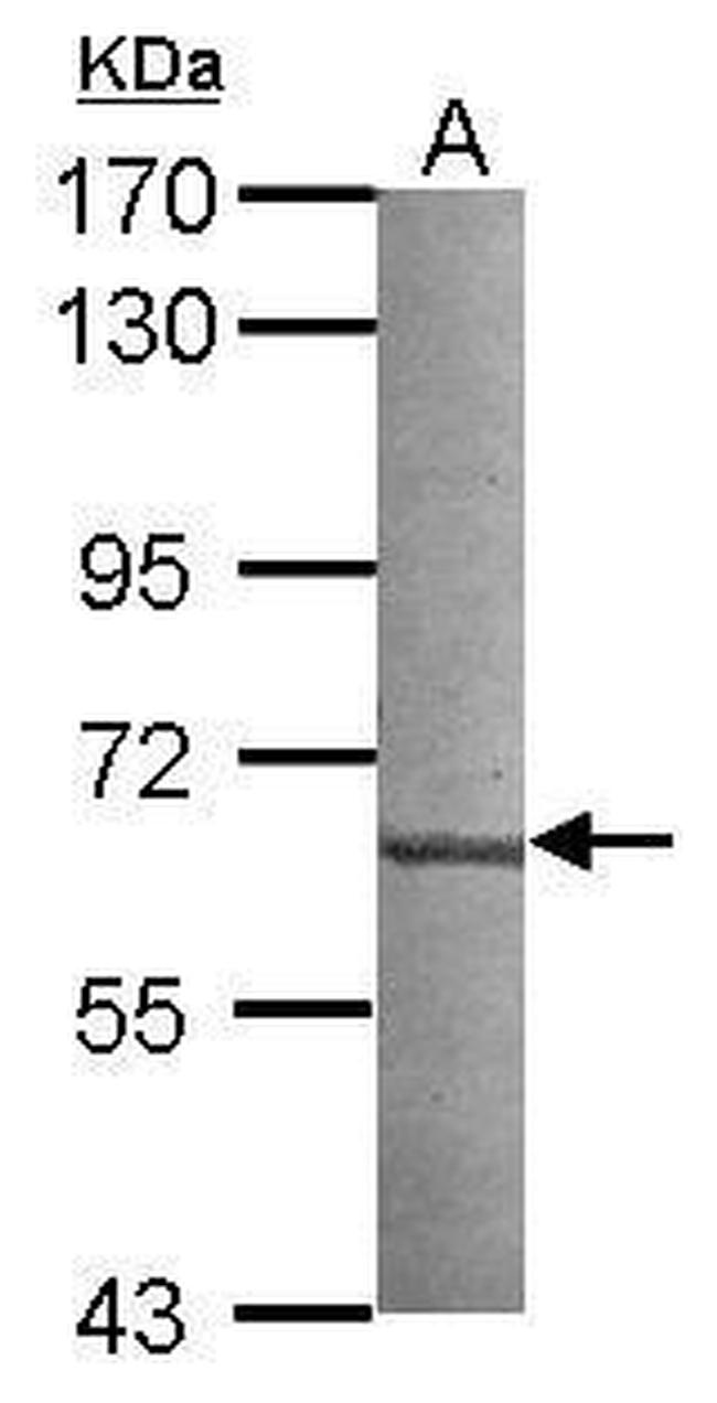 CML66 Antibody in Western Blot (WB)