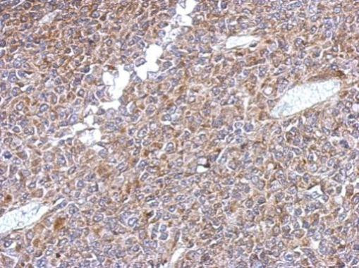 KLHL1 Antibody in Immunohistochemistry (Paraffin) (IHC (P))