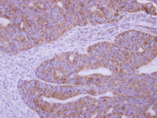 PLA2G12A Antibody in Immunohistochemistry (Paraffin) (IHC (P))