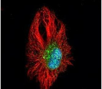 Tankyrase Antibody in Immunocytochemistry (ICC/IF)