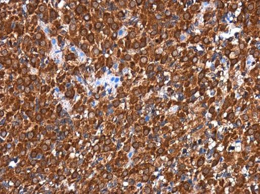 RGS6 Antibody in Immunohistochemistry (Paraffin) (IHC (P))