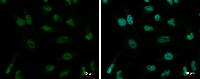 ZNF189 Antibody in Immunocytochemistry (ICC/IF)