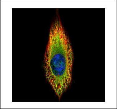 RIN2 Antibody in Immunocytochemistry (ICC/IF)