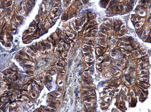 CLEC4A Antibody in Immunohistochemistry (Paraffin) (IHC (P))