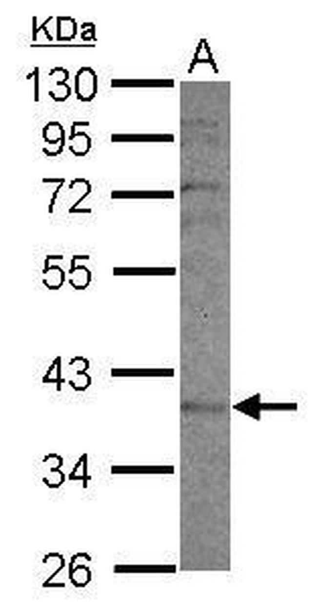 CYP2F1 Antibody in Western Blot (WB)
