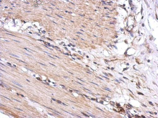 VLK Antibody in Immunohistochemistry (Paraffin) (IHC (P))