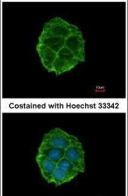 P2X3 Antibody in Immunocytochemistry (ICC/IF)