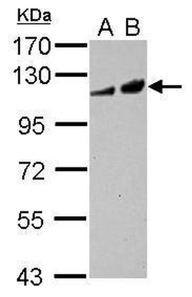 ADCY2 Antibody in Western Blot (WB)