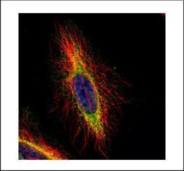 CPT1B Antibody in Immunocytochemistry (ICC/IF)