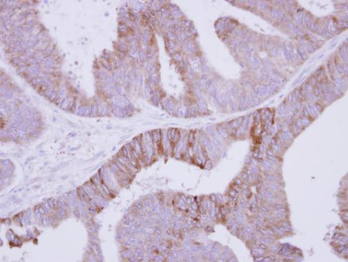 Jouberin Antibody in Immunohistochemistry (Paraffin) (IHC (P))